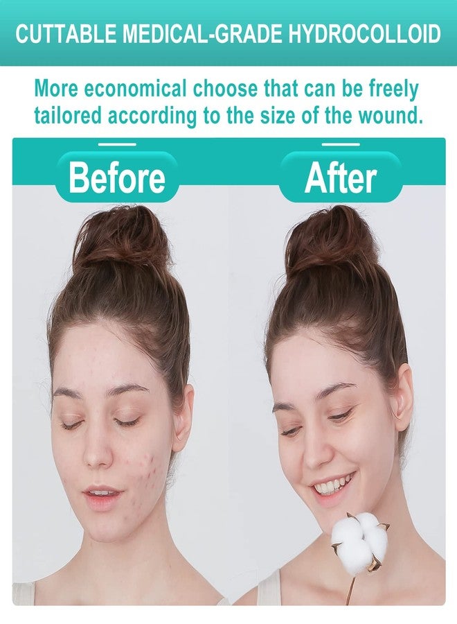 ديمورا ضمادات جروح هيدروكولويد من ديمورا، عبوة من 20 ضمادة، رقيقة للغاية، مقاس 4 بوصات × 4 بوصات، ضمادات لاصقة ذاتية اللصق - Image 5